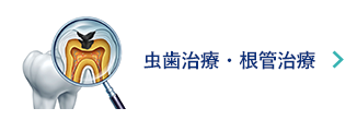 虫歯治療・根管治療